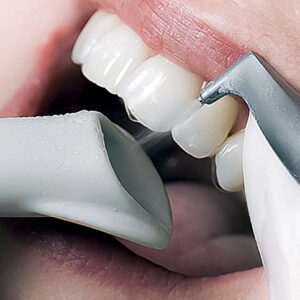 Nettoyage Air Flow